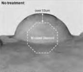 Before dressing: image labelled protrusion 10 µm.