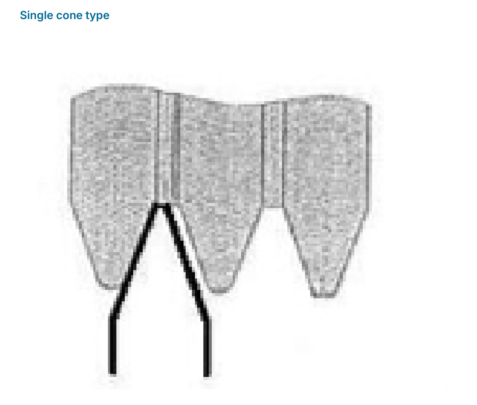 Single cone type: profile contact.