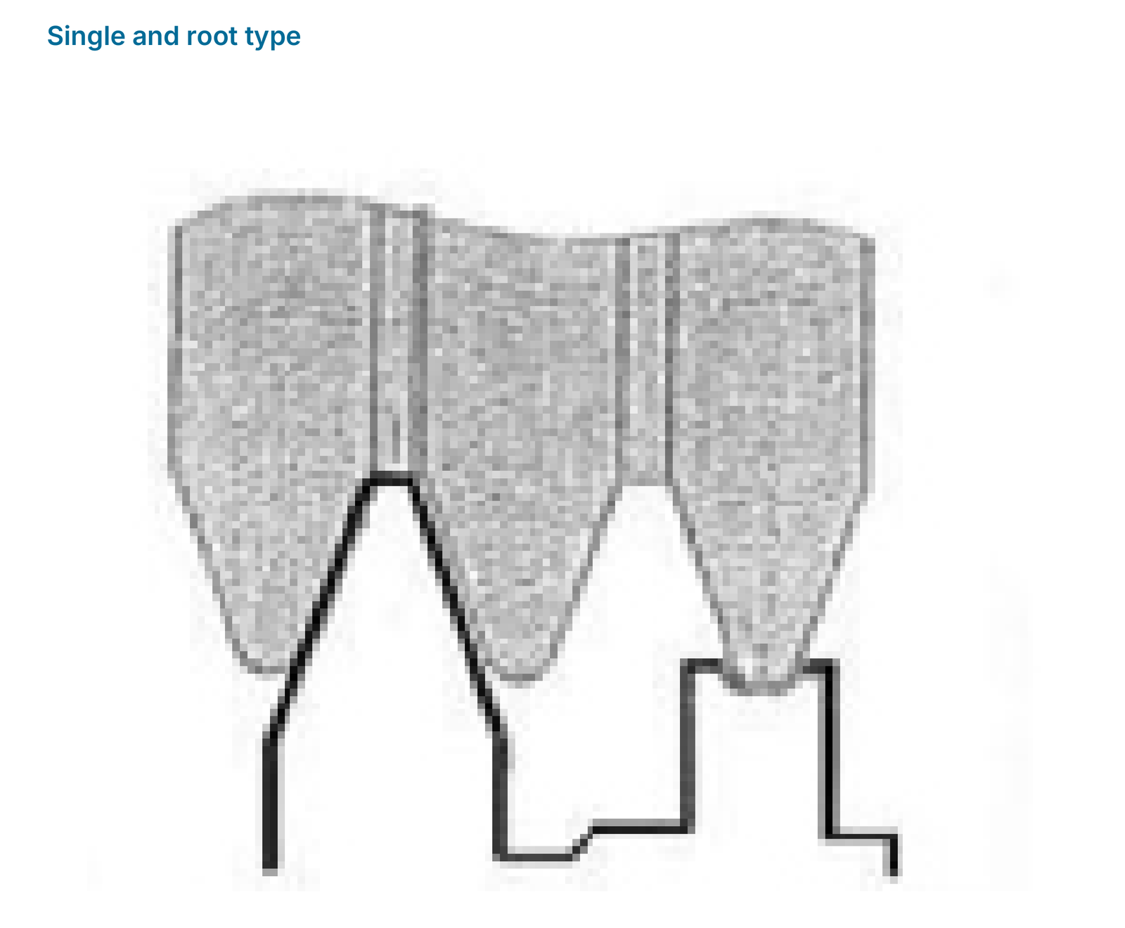 Single and root type: profile contact.