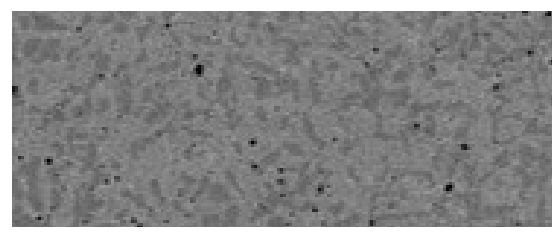 Scanning electron micrograph of the MP version.