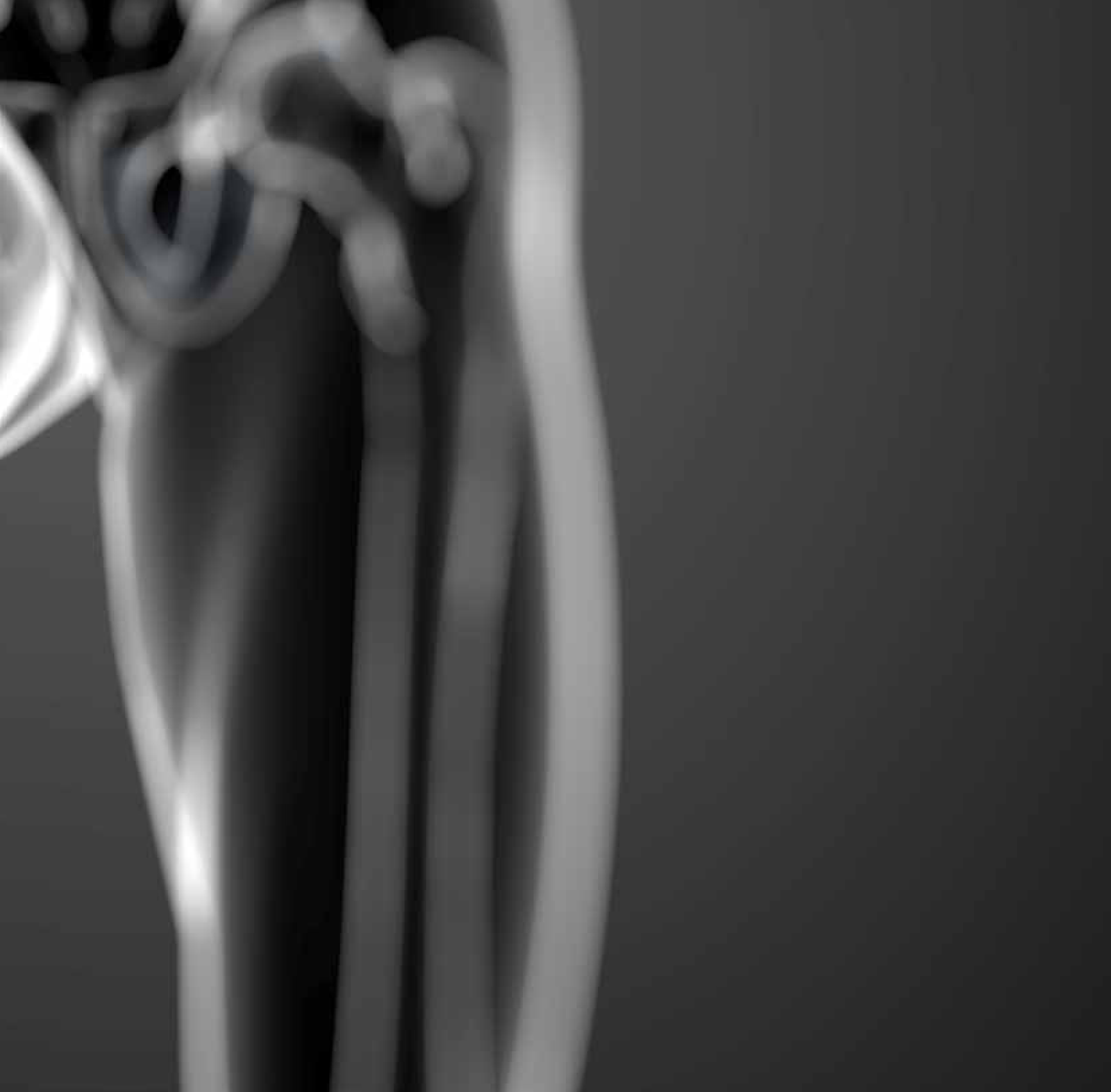Grinding tools for medical-component manufacture