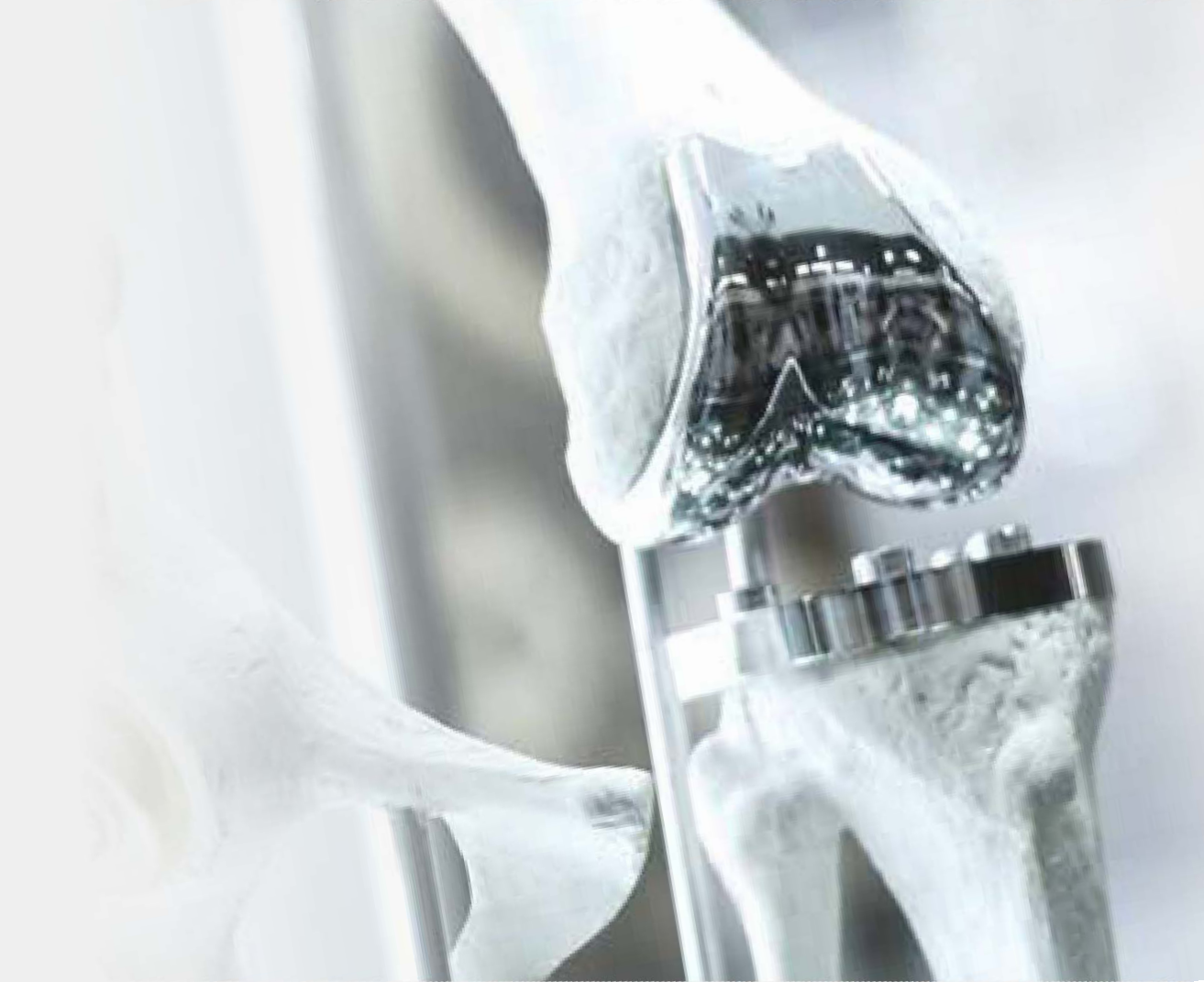 Artificial-knee component: machining application