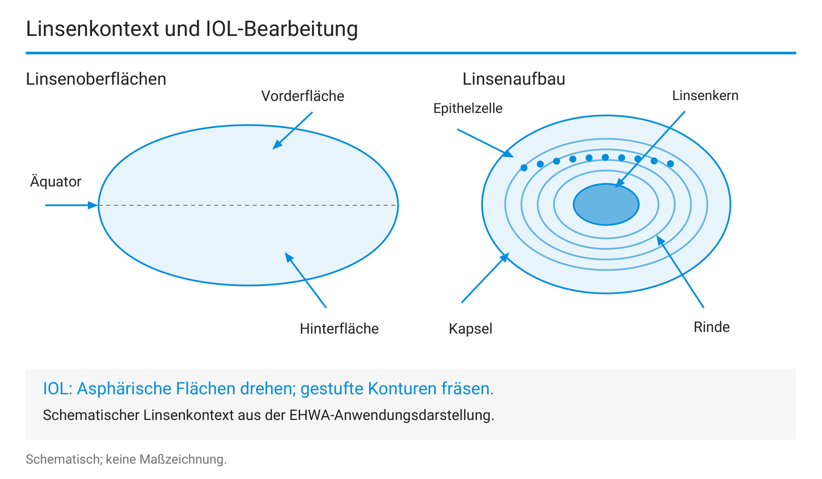 Lokalisierter Linsenkontext und IOL-Bearbeitungsaufgaben.